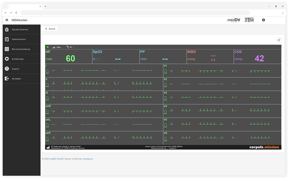 Screenshot vom NIDAtracker mit Darstellung einer EKG-Live-Telemetrie